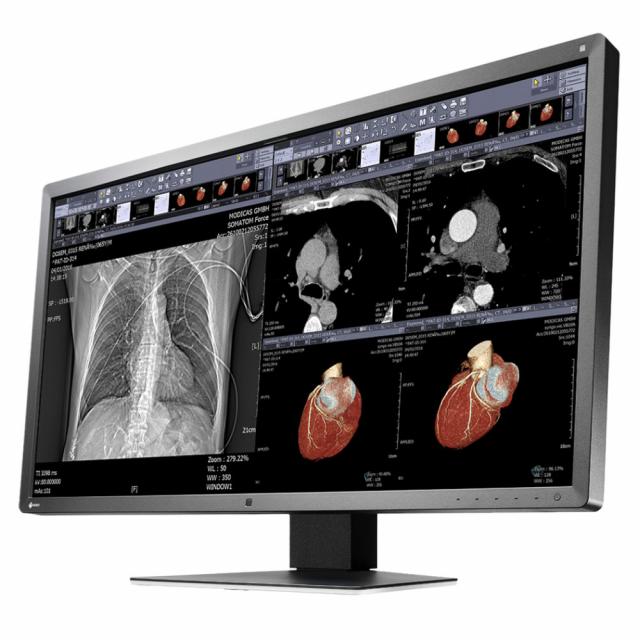 Медицински монитор EIZO RadiForce MX315W 8MP Цветен 